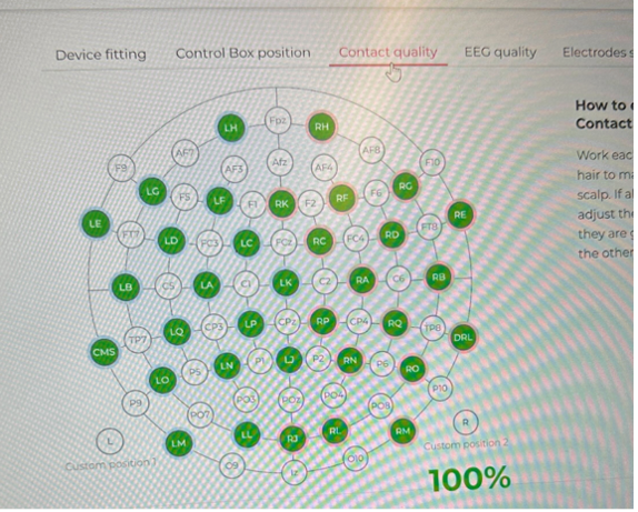 eeg quality