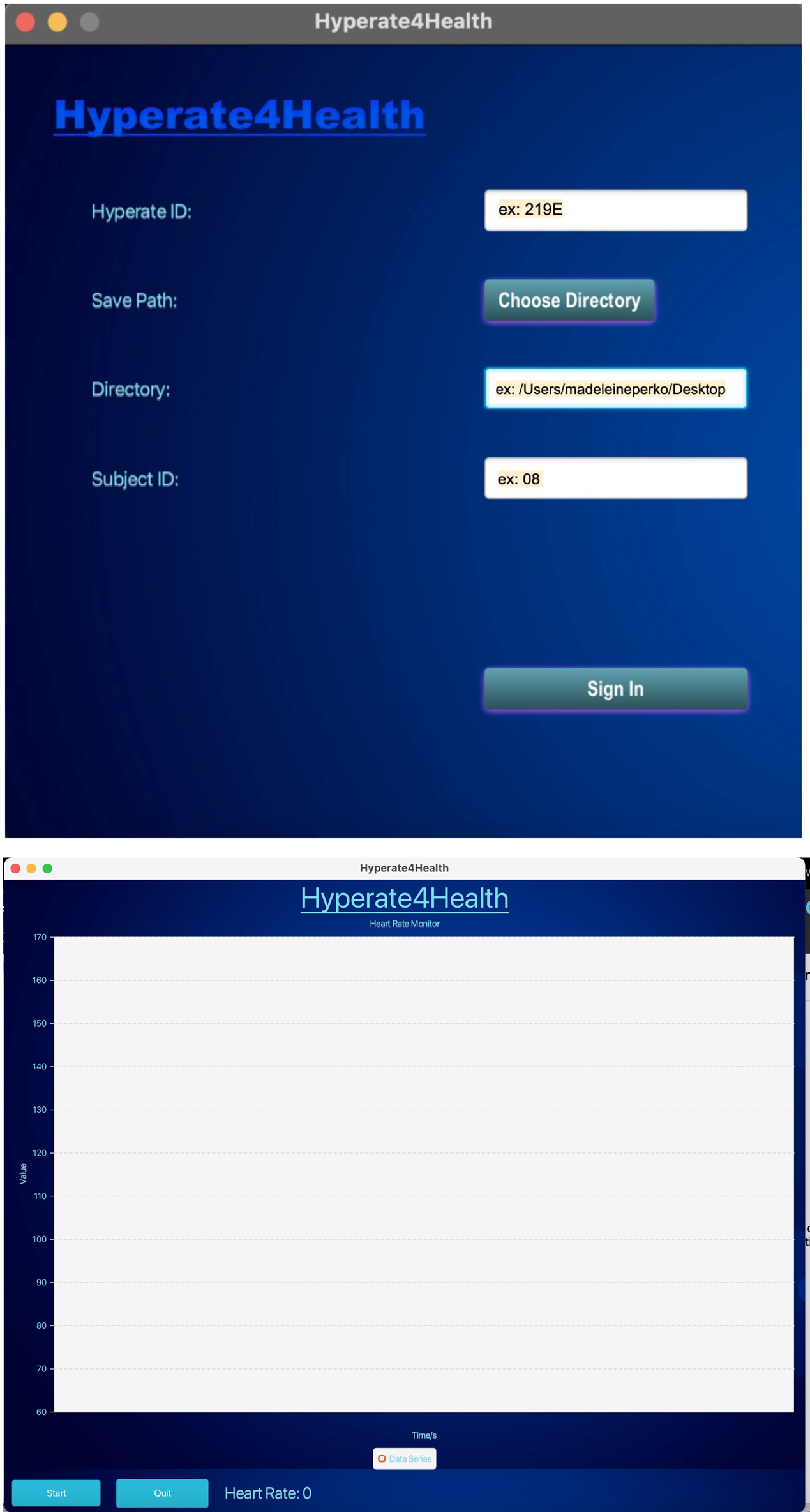 hyperate_home